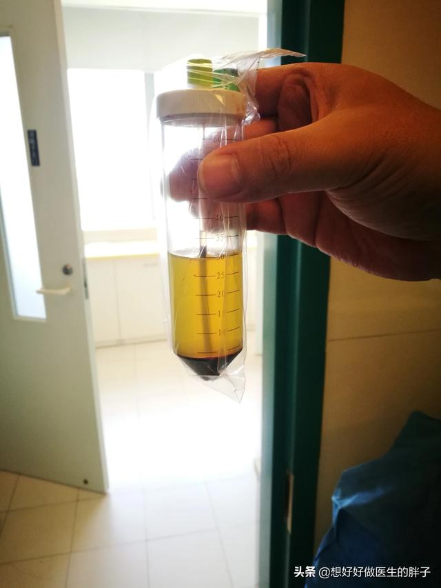 骑自行车膝关节酸是怎么回事,骑自行车时膝盖疼是怎么回事