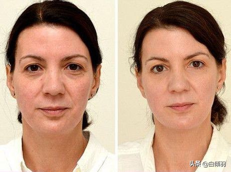 每天这样做皮肤柔嫩光泽,如何省钱买牛年限定皮肤