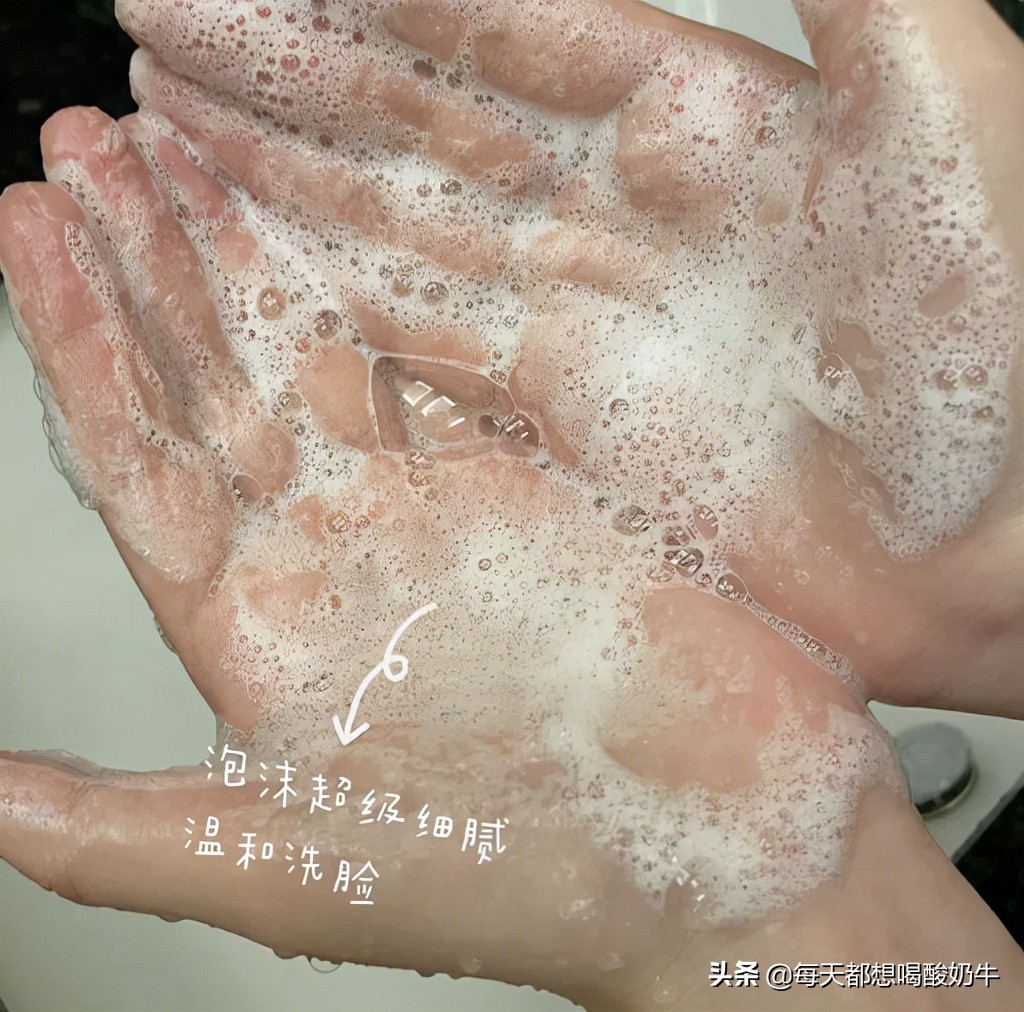 如何改善脸上皮肤特别薄，一直泛红，毛孔粗大，*血丝红**明显？