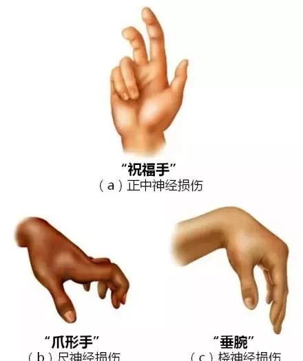 完整版神经系统医学美图看一眼就可以记住