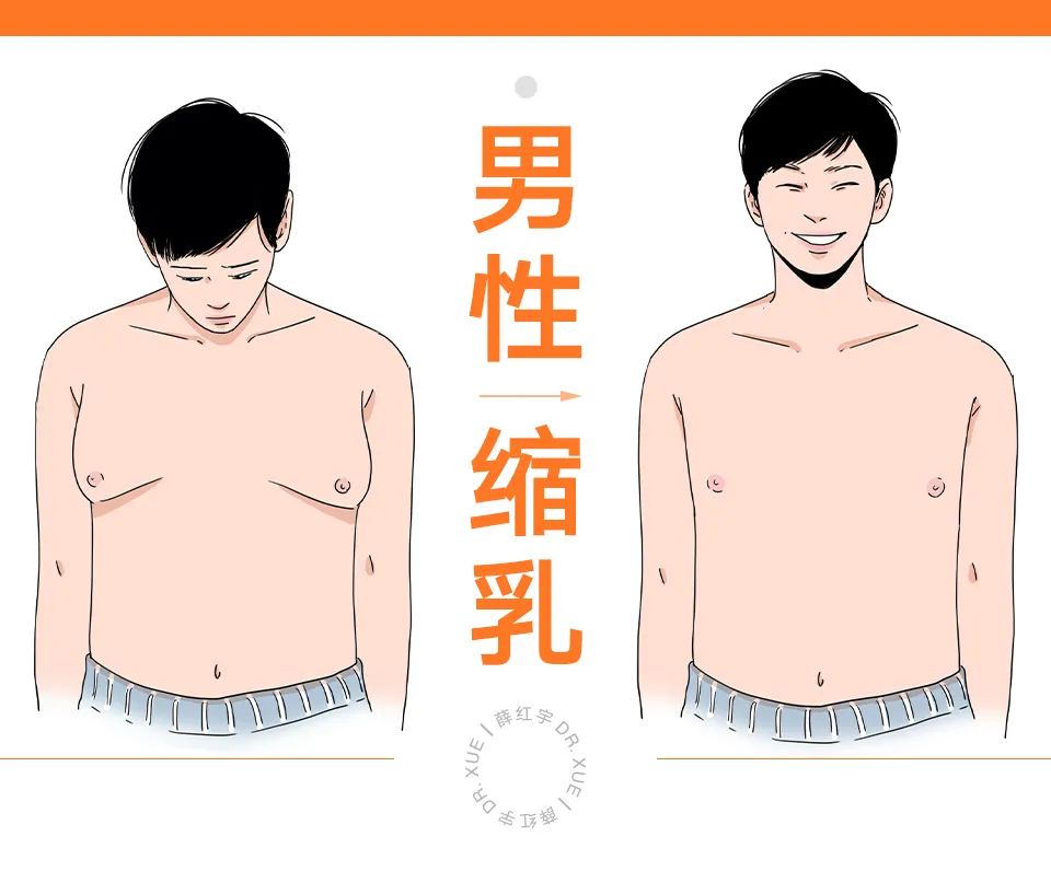 乳房缩小常见术式,乳房缩小术解除乳房过大的烦恼