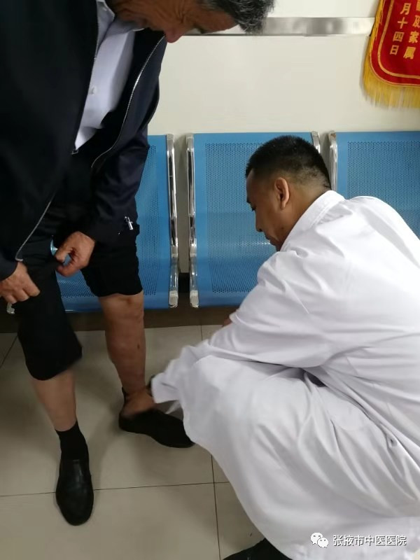 聚桂醇治疗静脉曲张护理操作,张掖市医院下肢静脉曲张微创手术