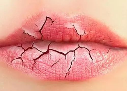 嘴唇干裂爆皮治哪个脏腑虚,嘴唇干裂是哪个内脏有问题