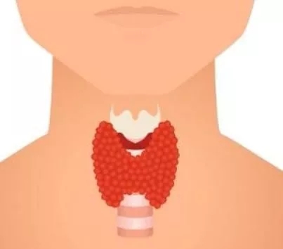 为什么甲亢好了又变成了甲减,甲亢用碘131治疗变甲减能治好吗