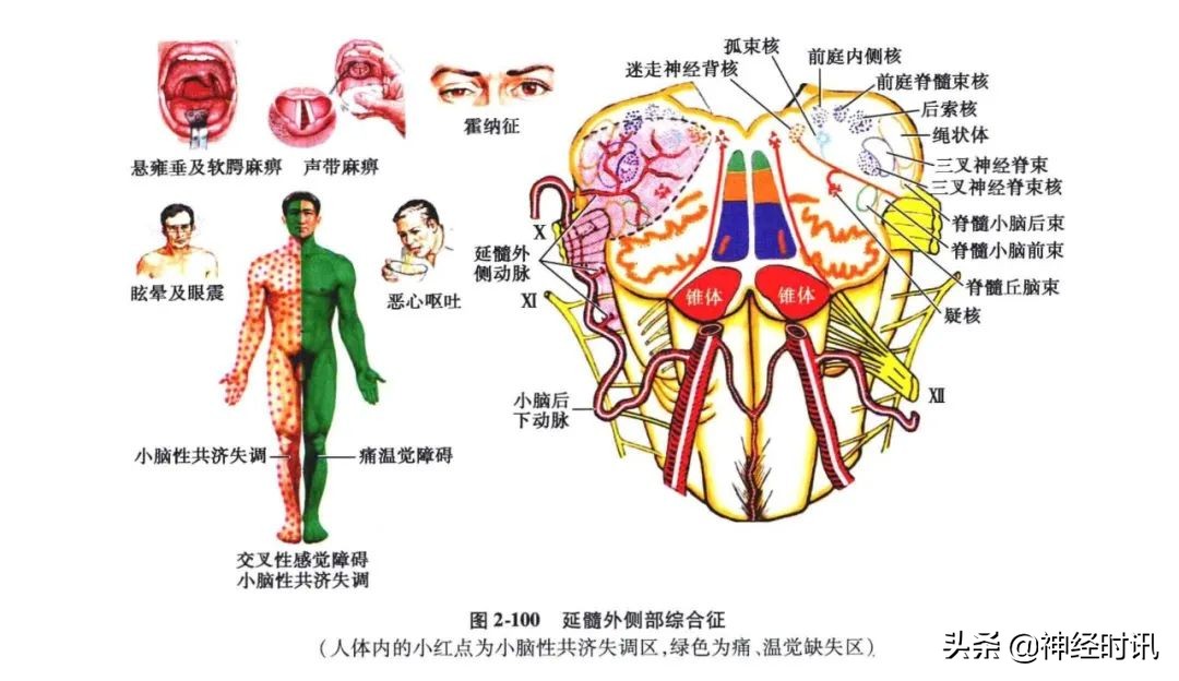 脑干解剖,脑干神经解剖