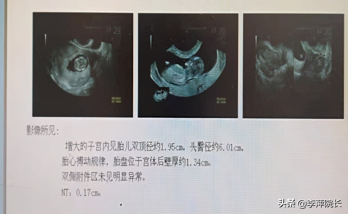 女子备孕前发现妇科病,女性备孕期出褐色的血