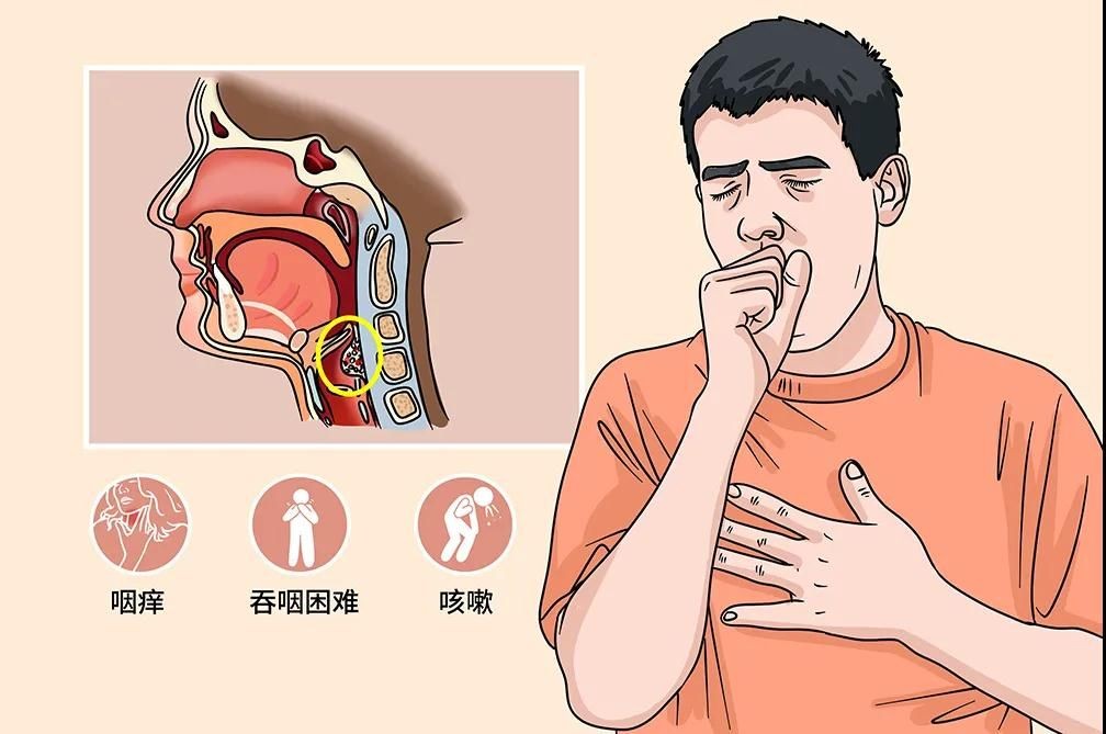 喉咙沙哑用动手术吗,喉咙沙哑需要住院治疗吗