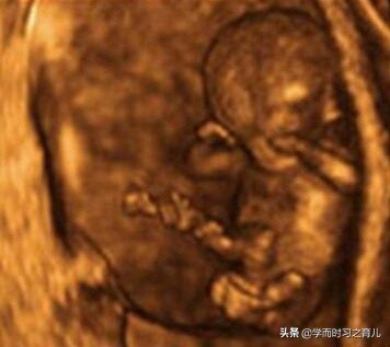 胎儿做四维照不到脸怎么办,四维彩超胎儿害羞捂脸不给看