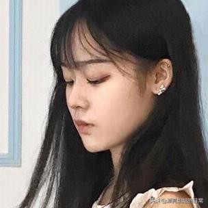 隆鼻改善蒜头鼻,蒜头鼻隆鼻一年后的真实感受