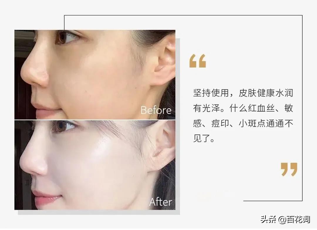 佰花方肌活焕肤精华水测评,臻萃养肤精华液