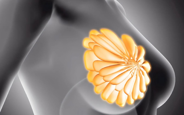 浆细胞性乳腺炎破溃有什么症状,浆细胞乳腺炎破溃后长肉芽了