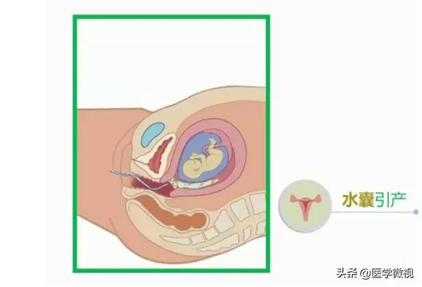 预测11月生娃高峰,2023年11月份怀孕生什么几率大