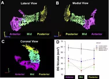 EPA和DHA是怎样抗炎的,dha真的对抑郁症有用吗