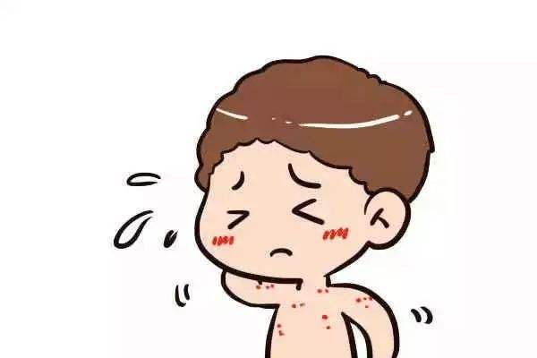 宝宝长痱子怎么办才能快速消除,宝宝长痱子怎么办快速解决