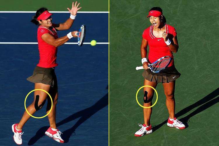 膝关节鹅足,有一种膝关节痛叫鹅足发炎