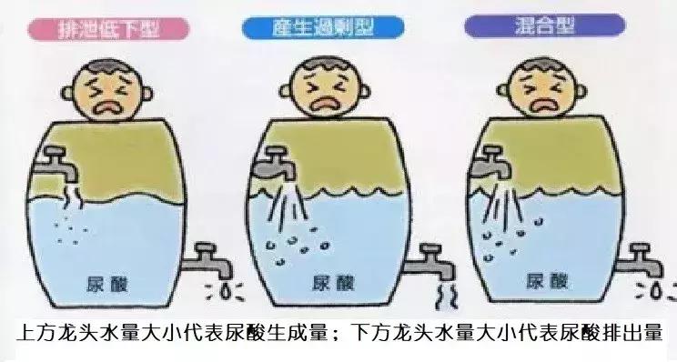 痛风饮食清单一览表,痛风病健康饮食手册