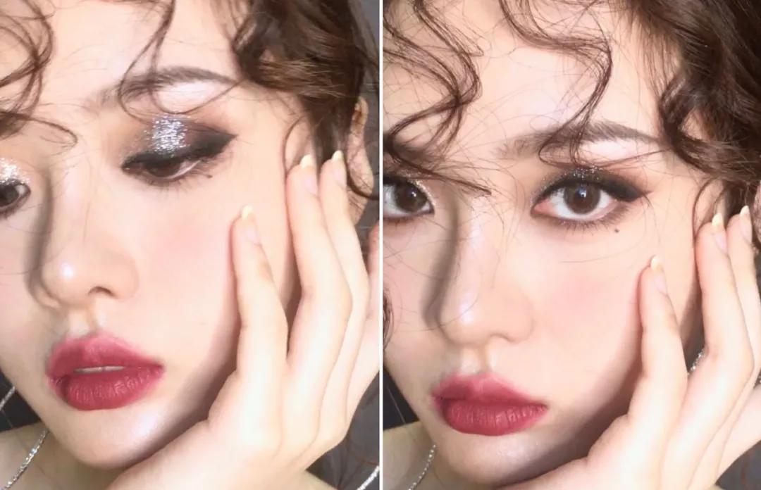 点痣就能变美,点痣整容大法