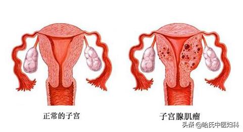 跟婆婆住一个套房总是被气怎么办,和婆婆住一起每天被气的要死