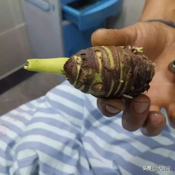 吃了野生芋头中毒了多久才好,吃完芋头千万别碰的食物