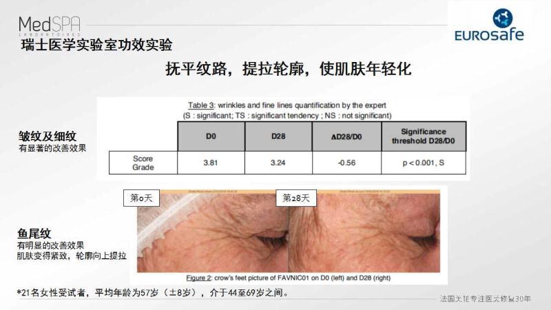 美帕涂抹肉毒素抗皱系列，用了后悔没有早点入手！