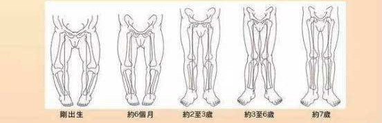 小孩喜欢勾腿是为什么,幼儿罗圈腿会自己好吗