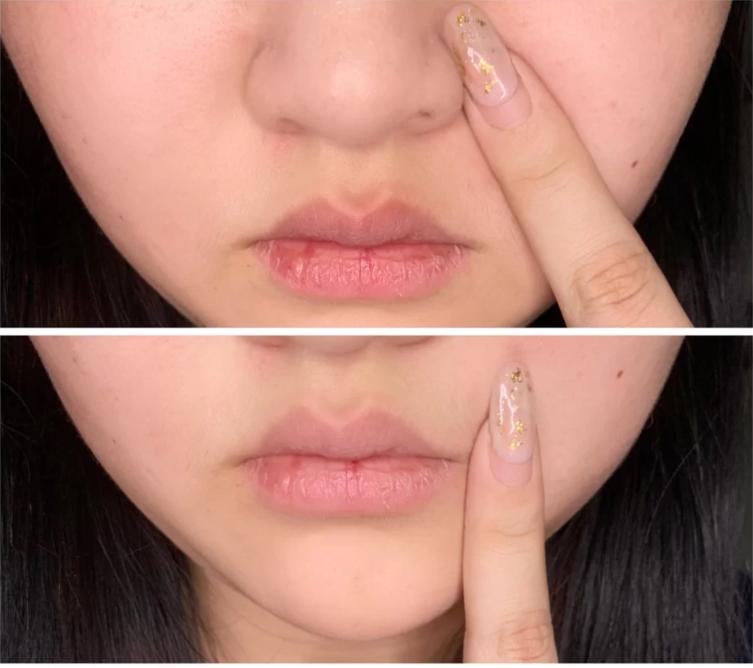 脸上的小瑕疵用什么护肤品比较好,脸部护肤的十大误区