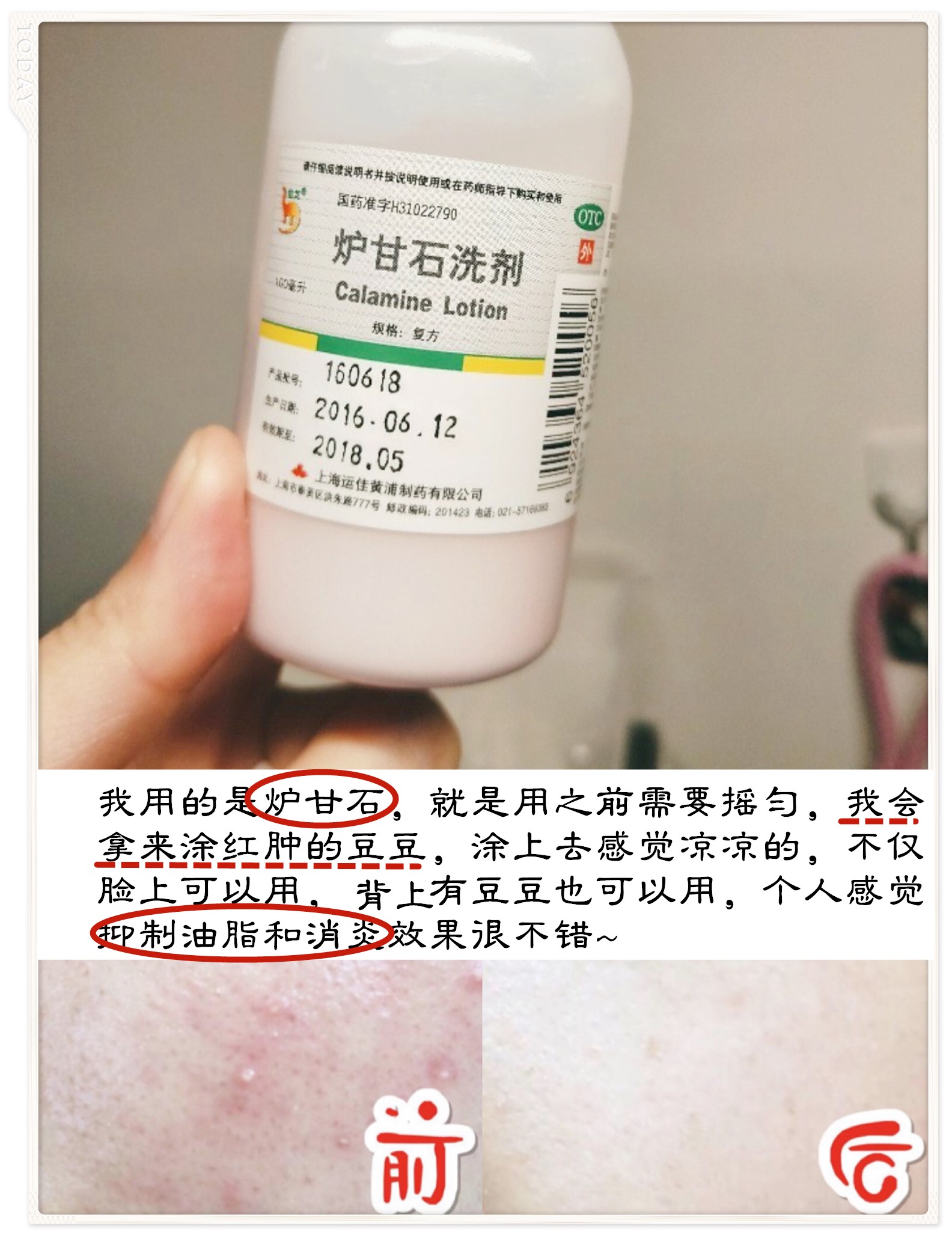 别爱我没结果，除非皮肤好过我，去黑眼圈细纹逆袭漫画眼