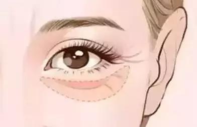 激光美容时遇到睑缘肿物，用激光和手术切除有啥区别？