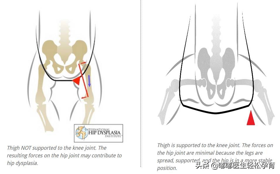 宝宝背带有什么弊端,婴儿背带用哪种好一点