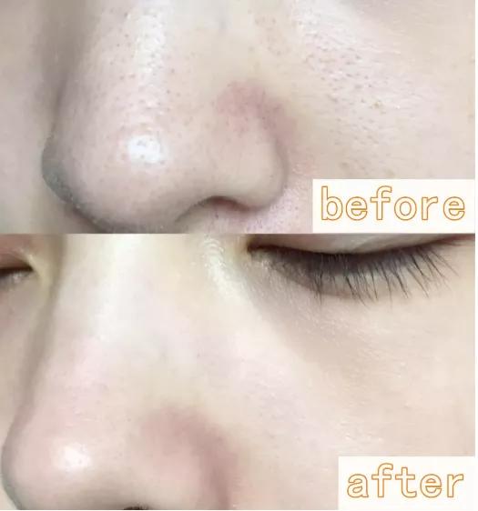 亲测好用这款网红泡泡面膜爆了,一款不错的泡泡面膜