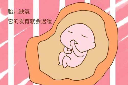 有了这几个症状要特别留意胎儿宫内缺氧了