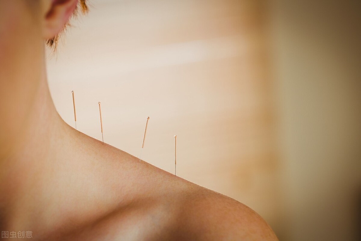 养生保健场所针灸算非法行医吗,理疗馆治疗事故是非法行医吗