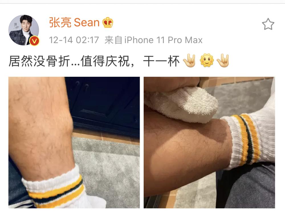 张亮晒受伤照被网友骂遭报应，看来只有官宣真相才能救回人设