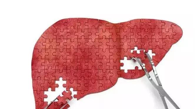 肝囊肿要治疗吗什么原因引起,肝囊肿14x13mm要不要紧