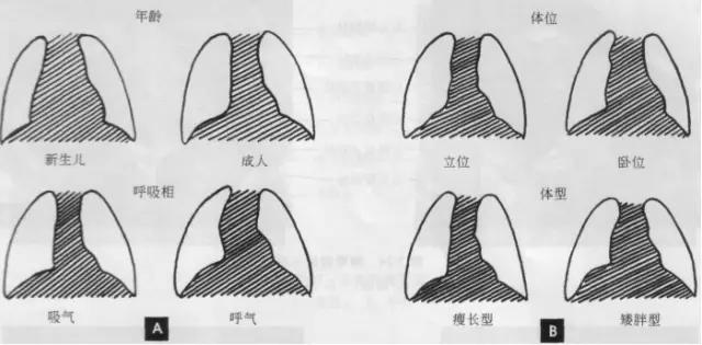 收藏：详细的胸部X线解剖，最基础最实用