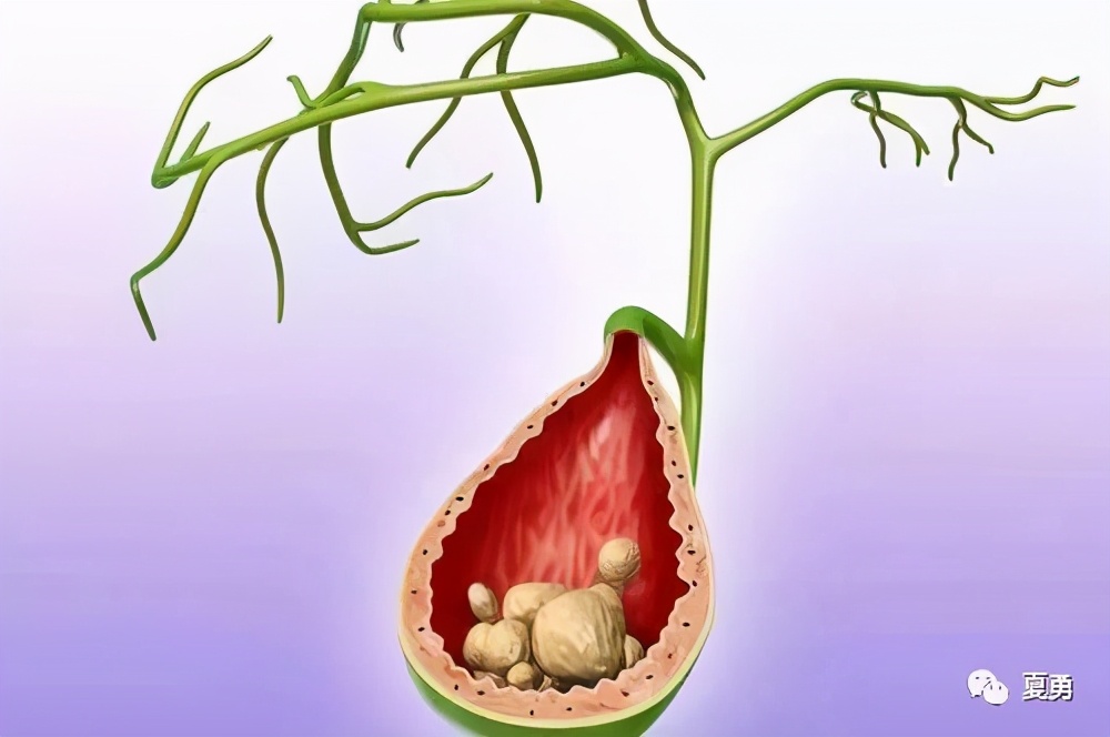 癌症王中王活下来的人,癌症王中王是指什么病