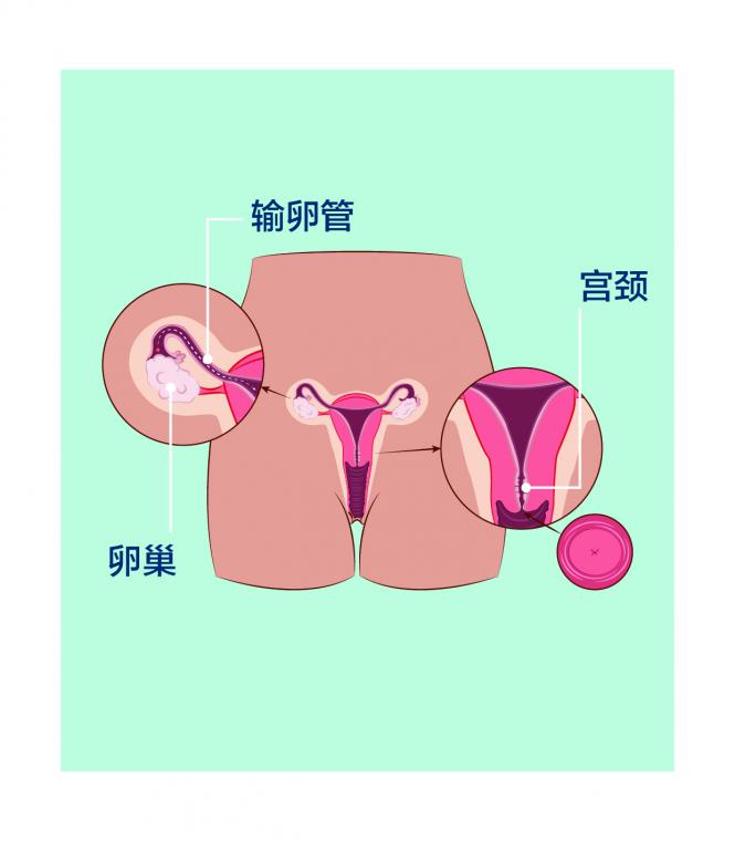 小便之后不用纸擦为什么有异味,小便之后要不要用纸巾擦