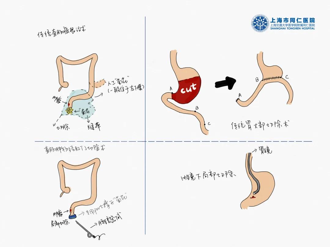 患两种癌的人能活多久,一个人同时患上三种癌能治好吗