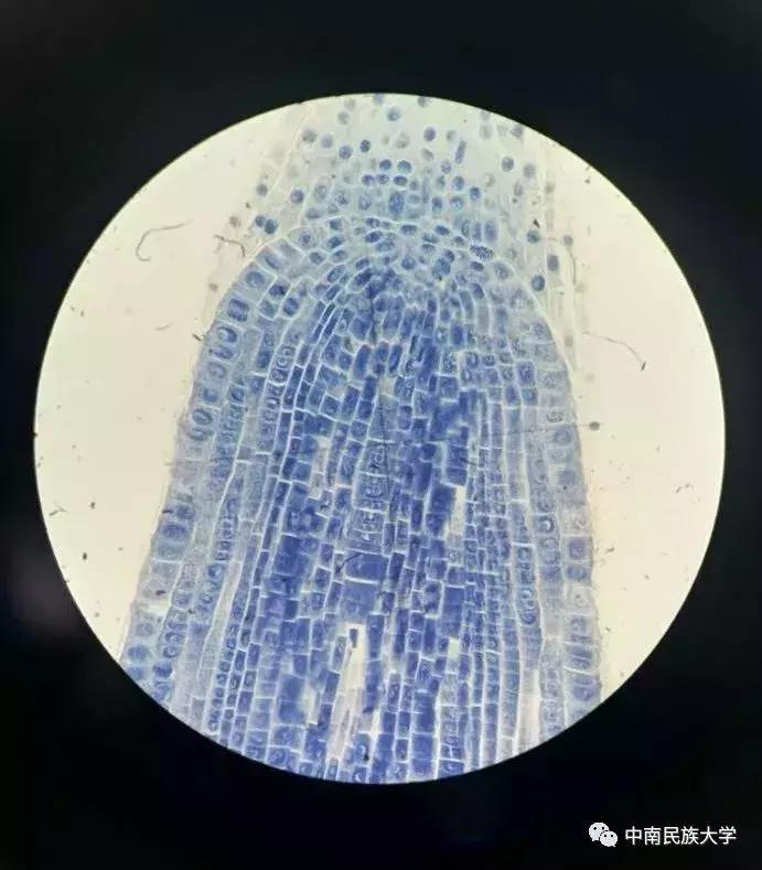 高考志愿填报中南大学,为啥高考志愿倾向报本省