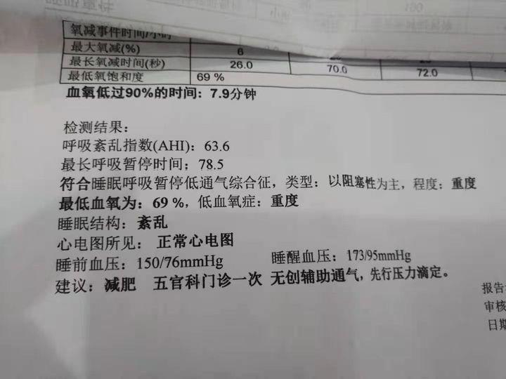 打鼾不通气小妙招,唱歌能治疗打鼾吗