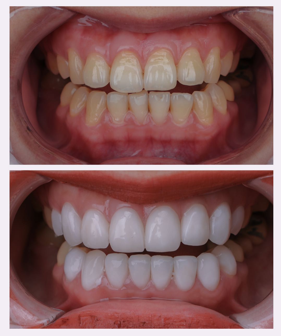 2023年女人最关注的问题,不要整容要整牙