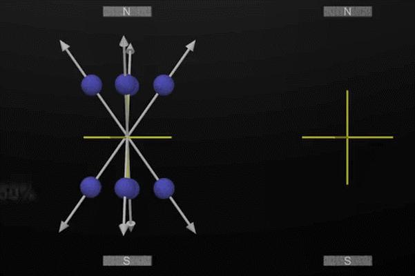磁共振怎么看大脑基底节区和丘脑,脑核磁能不能看清楚骨头