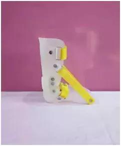 关于儿童足外翻，你误会了多少？后悔科普太晚了