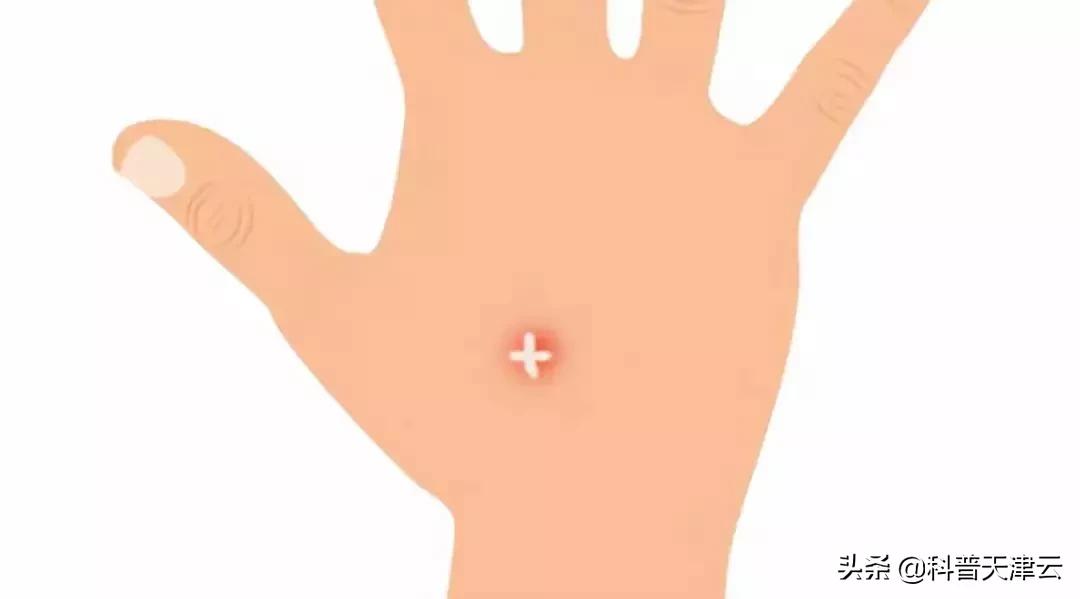 儿童被蚊子咬了怎么止痒消肿,宝宝蚊子包怎样快速消肿止痒