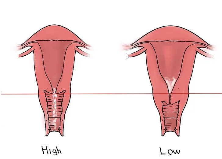 更年期外阴萎缩症状,外阴萎缩痒用什么药