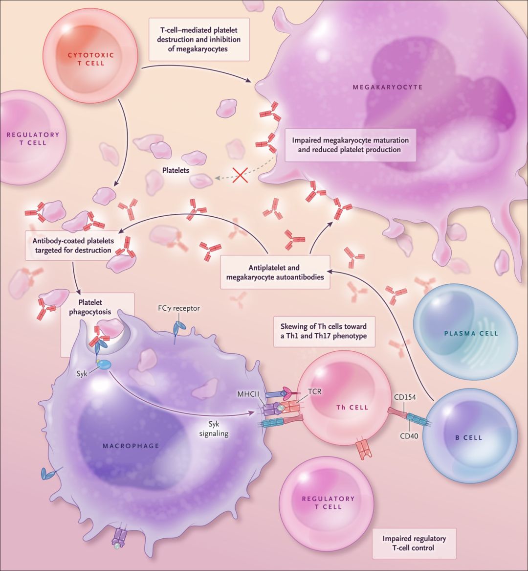 NEJM教你ImmuneThrombocytopenia,ITP所需要知道的一切