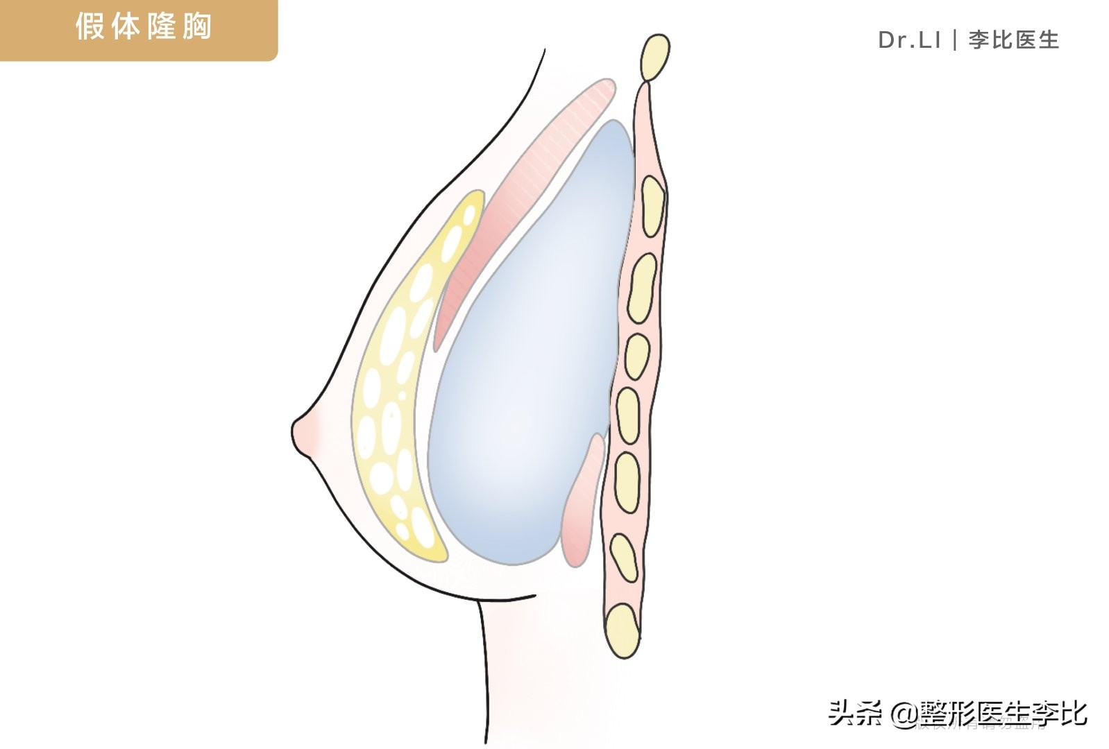 我有一对不会长大的胸，怎么办？（含案例）