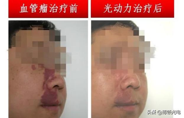 激光技术哪些领域好,激光行业的关键技术