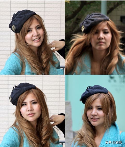 18岁土肥圆豪掷800万全身整形，鼻子6次大整假体穿出，效果却超美