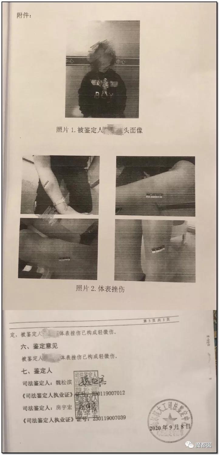 短跑名将张培萌被曝家暴,短跑名将张培萌殴打岳母被行拘